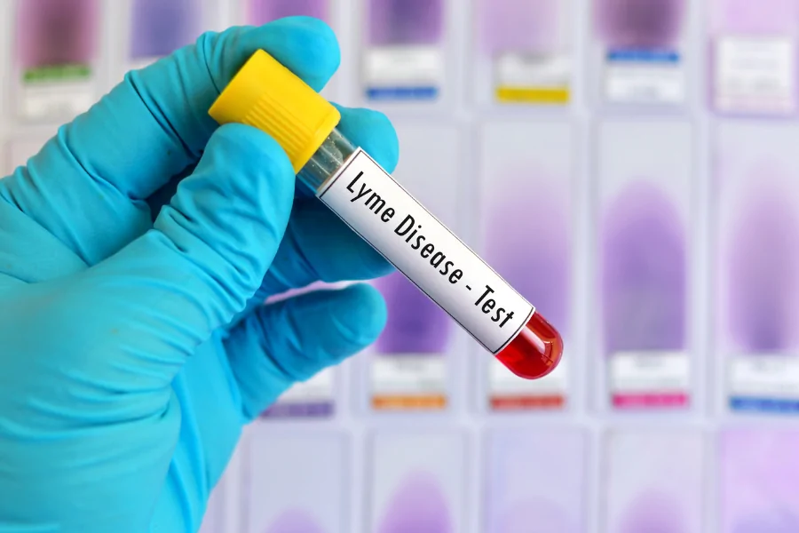 Lyme disease specialist reviewing tick panel and co-infection test results in Villanova, PA